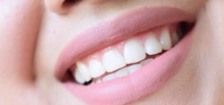 Safe teeth whitening at home