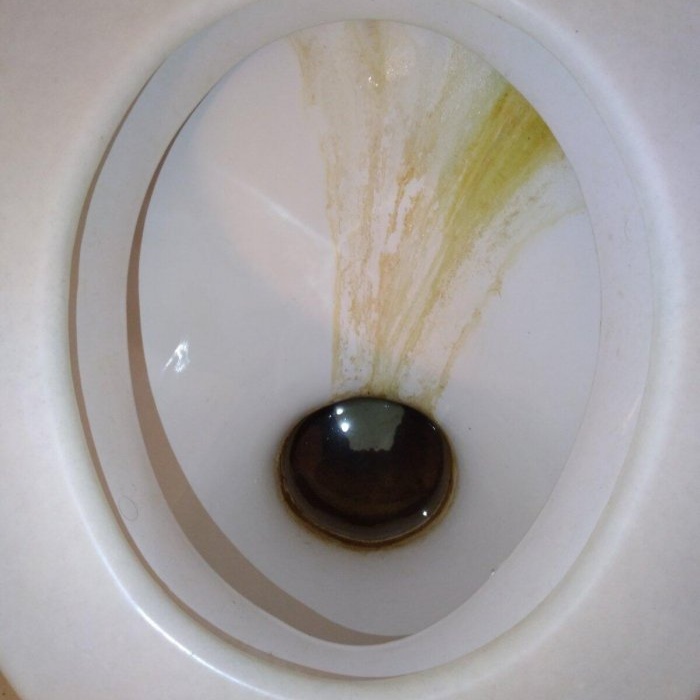 How to clean a toilet from rust and plaque with your own hands